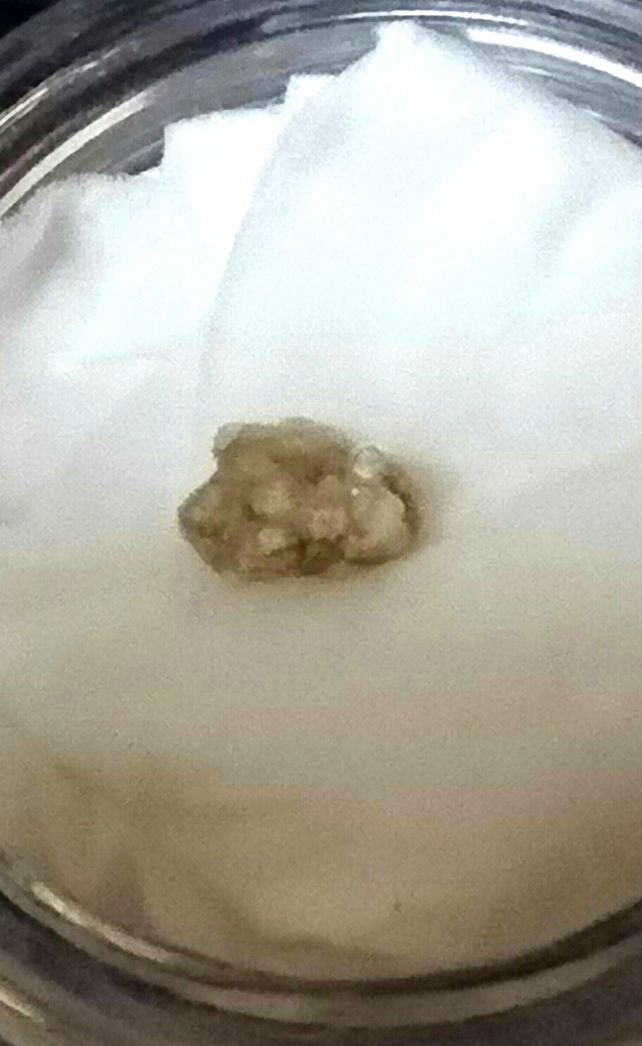 綿の上の茶色い塊